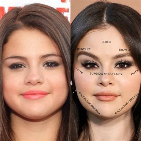 Selena Gomez: Before and After